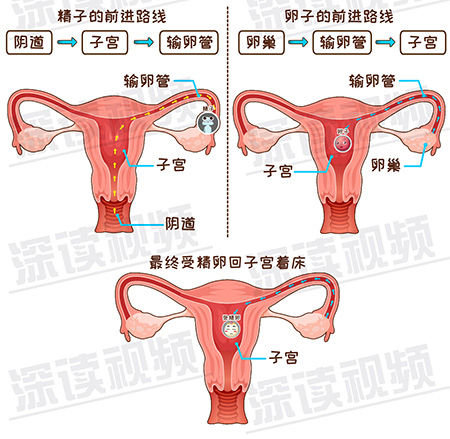 宫外孕-2-4.jpg